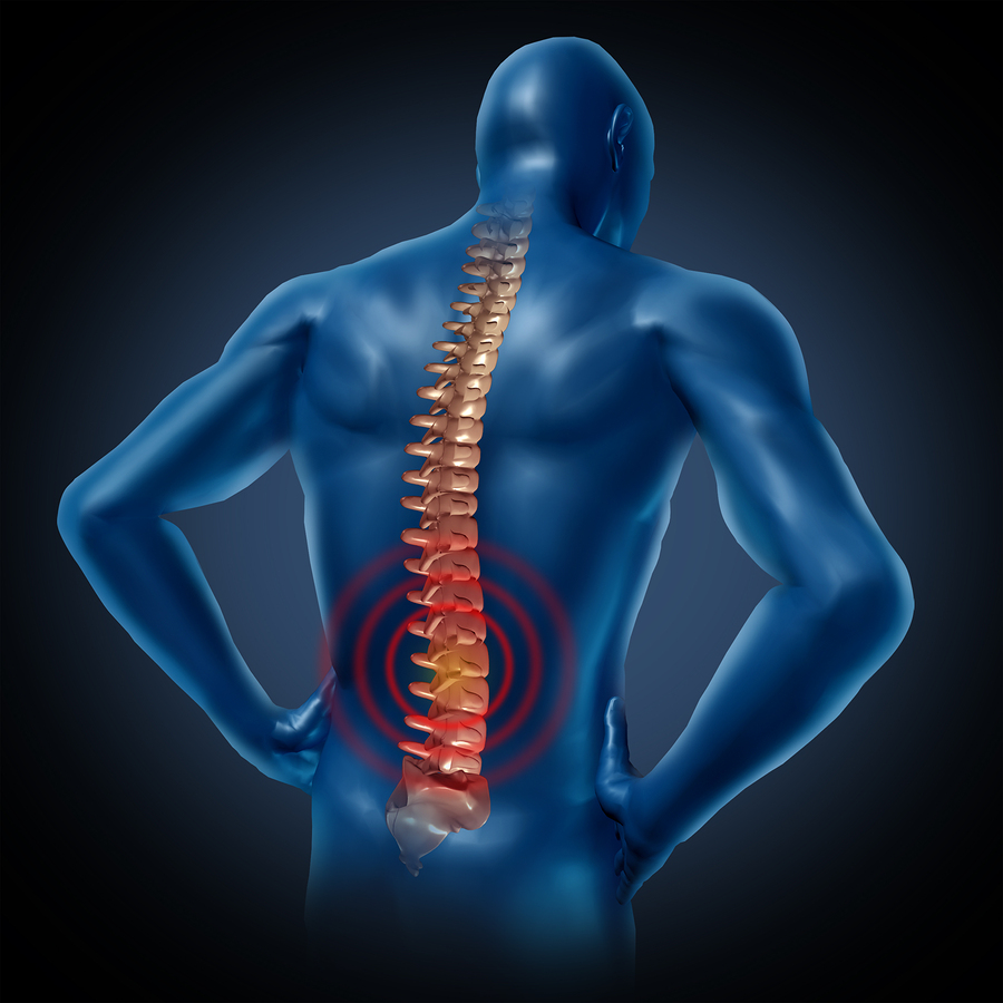 Workplace back injury and pain: How to minimise and manage